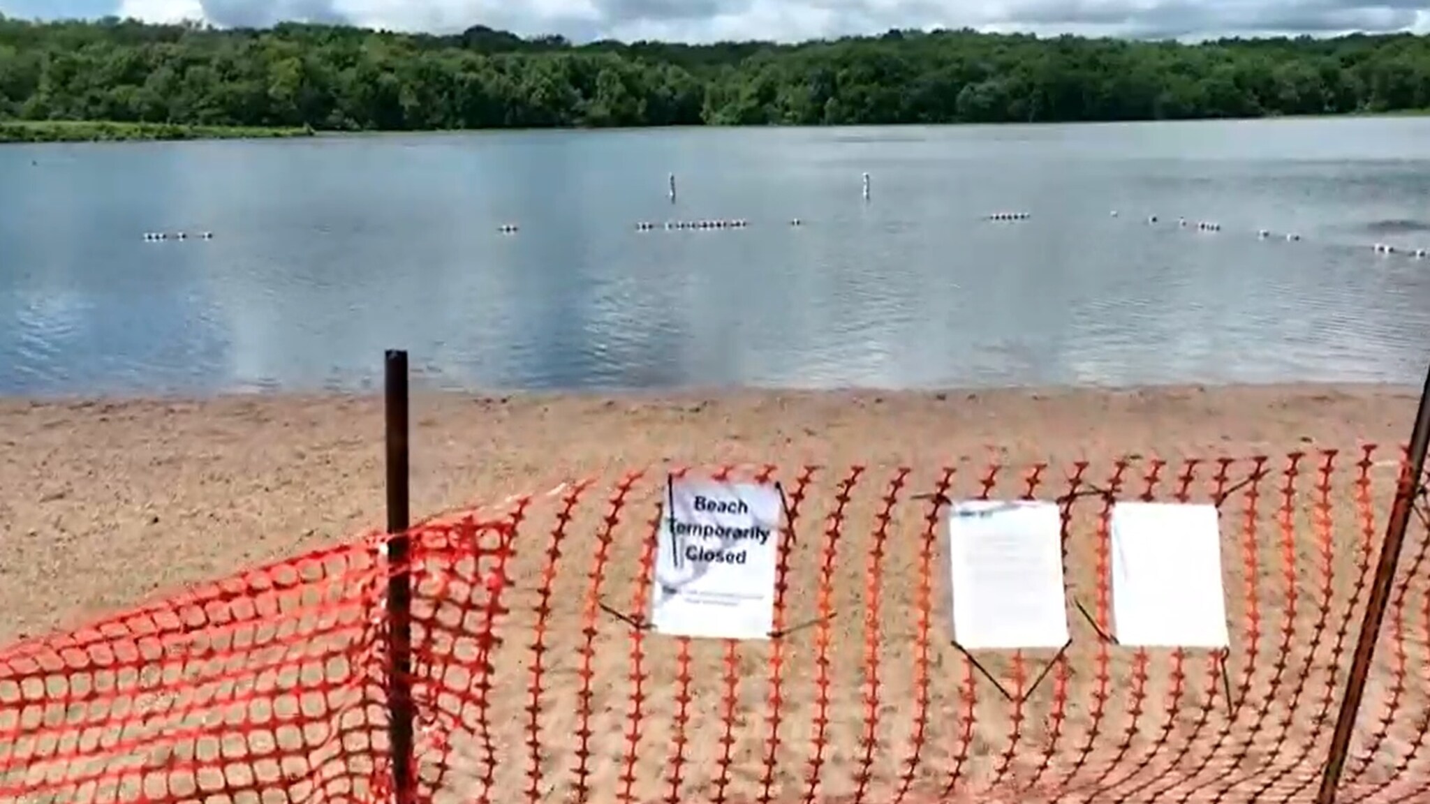 Brain-eating amoeba hits US lake: man in intensive care