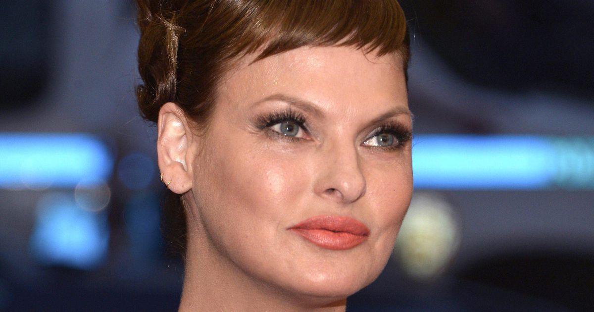 Linda Evangelista settles CoolSculpting suit after botched surgery |  stars